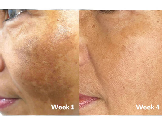 Kojic Acid & Turmeric Soap